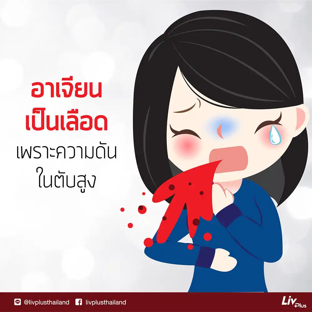 สัญญาณโรคตับ: อาเจียนเป็นเลือด