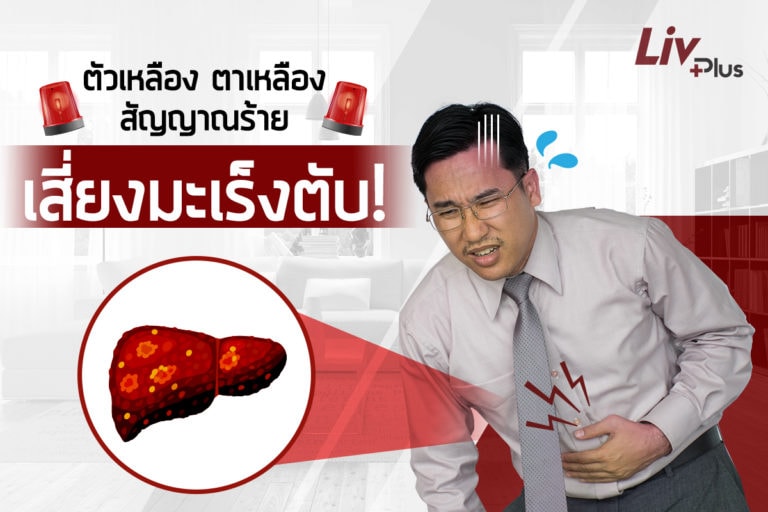 ชายหนุ่มมีอาการตาเหลืองแต่ไม่ทราบว่าเกิดจากอะไร
