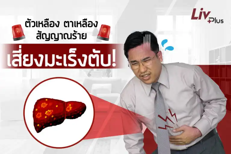 ชายหนุ่มมีอาการตาเหลืองแต่ไม่ทราบว่าเกิดจากอะไร
