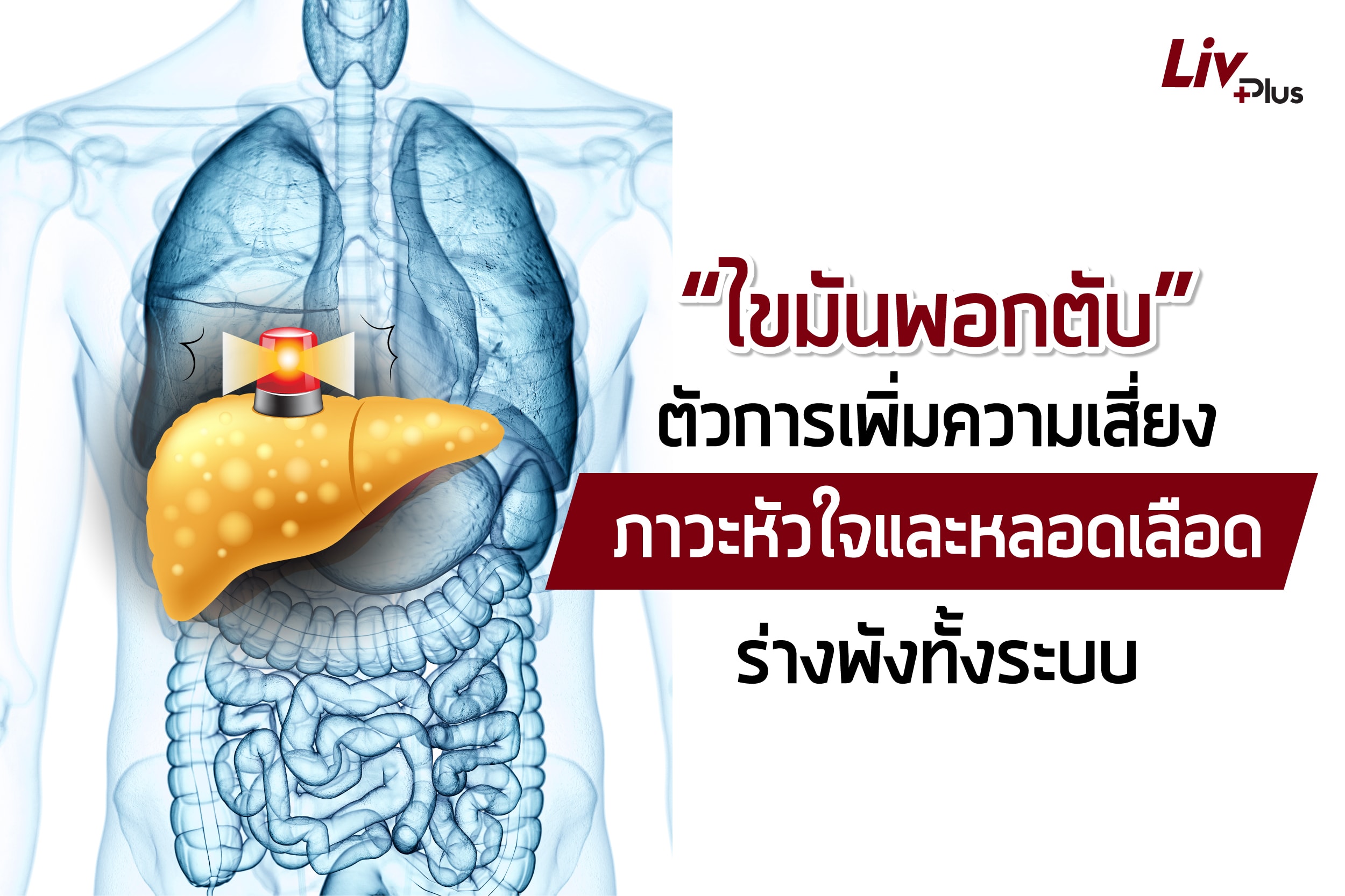 Read more about the article “ไขมันพอกตับ” ตัวการเพิ่มความเสี่ยง ภาวะหัวใจ และหลอดเลือด ร่างพังทั้งระบบ!