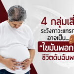 4 กลุ่มเสี่ยง…ระวังภาวะแทรกซ้อนอาจเป็น “ไขมันพอกตับ” ชีวิตดับฉับพลัน