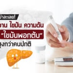 อย่าละเลย เบาหวาน ไขมัน ความดัน เสี่ยง “ไขมันพอกตับ” สูงกว่าคนปกติ