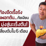 ท้องอืดเรื้อรัง ไขมันพอกตับภัยเงียบ มุ่งสู่มะเร็งตับ เสี่ยงดับใน 6 เดือน