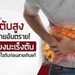 ค่าตับสูง ภัยร้ายอันตราย! เสี่ยงมะเร็งตับ ควรใส่ใจตับก่อนสายเกินแก้