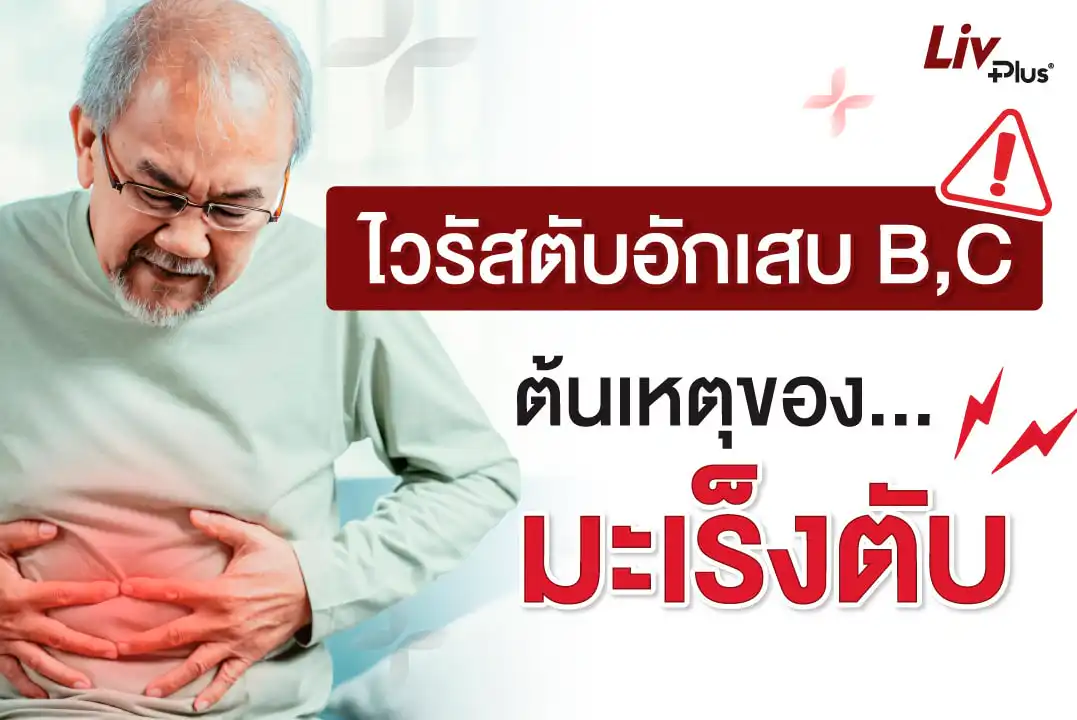 ไวรัสตับอักเสบ B, C ต้นเหตุของ “มะเร็งตับ”