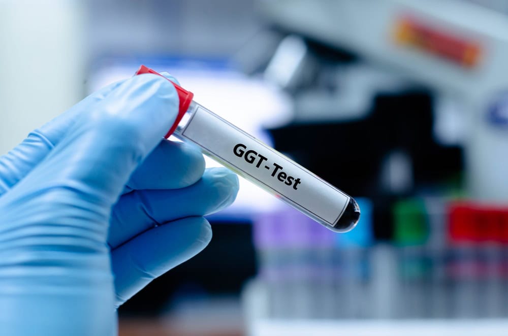 Read more about the article ค่า GGT คืออะไร ? ทำไมบอกสุขภาพตับได้อย่างแม่นยำ