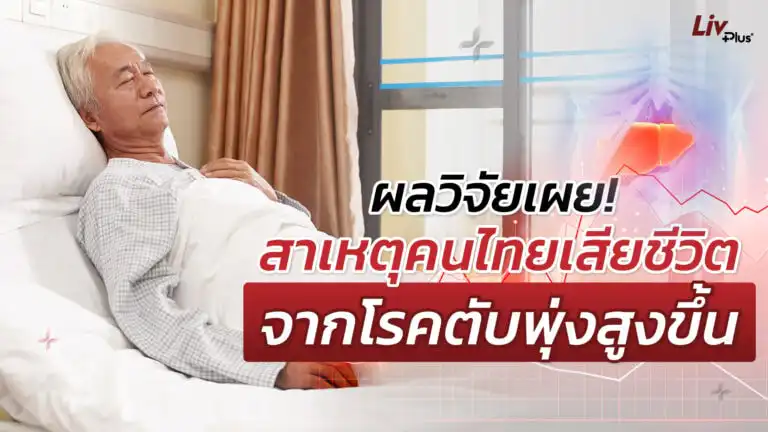 ค่าตับดูอย่างไร พร้อมวิธีป้องกันไม่ให้ค่าตับสูงเสี่ยงเสียชีวิต