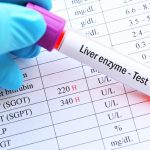 ค่าตับสูงเกิดจากอะไร มีสัญญาณเตือนอย่างไร พร้อมวิธีลดค่าตับ